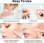 Pimple patch Qustere - Parches para el acne Qustere 300 unidades redondos