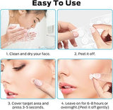 Pimple patch Qustere - Parches para el acne Qustere 300 unidades redondos