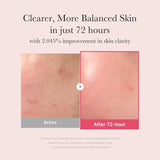 Serum de Niacinamida 15% TXA - Medicube