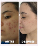 Serum Despigmentante New Skin Vibes