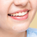 Parches anti-acne Lula