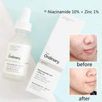 Niacinamide The Ordinary